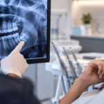Extração de siso: como funciona o procedimento e o que esperar da recuperação